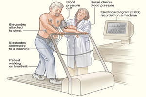 Tread Mill Test